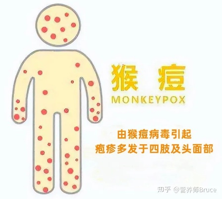 狗与人同床或致猴痘风险，需警惕