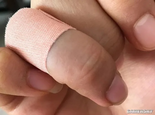 男子熟睡时疑被老鼠咬破头，噩梦背后的警示