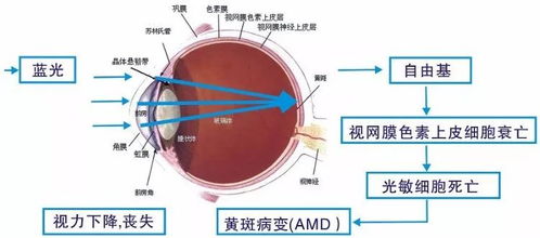 眼睛人工晶体使用寿命揭秘，如何延长其使用寿命的方法与知识科普