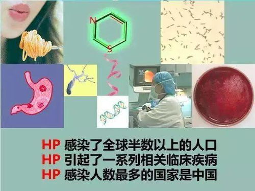 江苏启动幽门螺杆菌筛查项目，守护民众健康新举措
