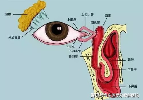 男子忽视肾结石，小病变大病引发危机